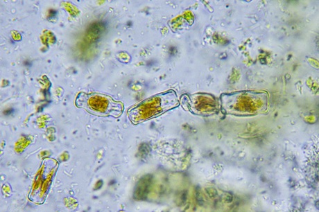 Diatoms under the microscope. Diatoms under the microscope.