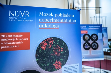 Výstava Mozek pohledem biomedicíny
