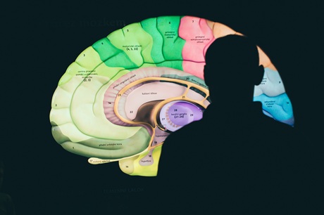 Olomouc - Pevnost poznání