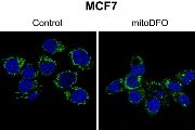 Fragmentace mitochondrií a jejich pohyb směrem k buněčné periiferii