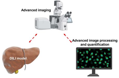 Using advanced imaging techniques in solving drug-induced liver injury