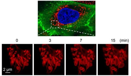 Interval imaging of mitochondrial damage in liver cells, provided with a super-resolution spinning disc microscope