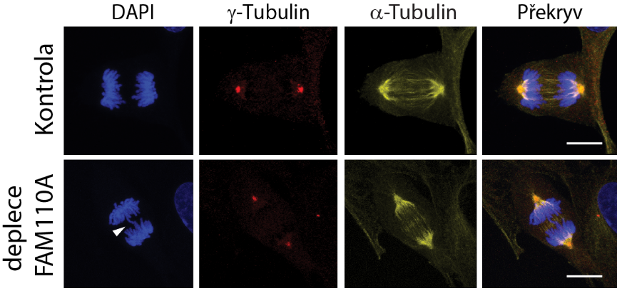Ztráta FAM110A vede k chybnému rozdělení chromozomů v průběhu mitózy