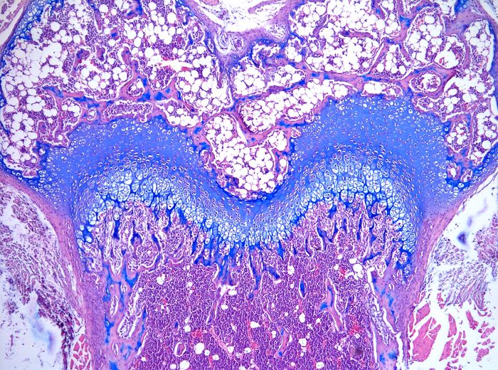 Histologický řez kloubní hlavicí stehenní kosti myši. Modře je obarvena chrupavka, která je u achondroplázie zkrácena.