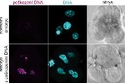 Normální a poškozené embryo při manipulaci s genem CHK1. V prvním řádku se myší embryo vyvíjelo správně, ve druhém je obarvena poškozená DNA. Poškození DNA (první panel) a rozpad chromozomů (prostřední panel) v rané fázi vývoje embrya vede k jeho zániku a tedy neplodnosti. Upraveno z publikace v Nature.