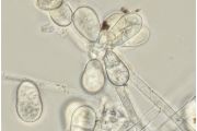 Arthrobotrys oligospora 