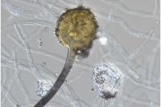 Aspergillus aculeatus 