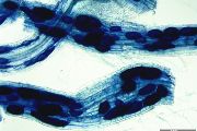 Kořeny jetele obarvené trypanovou modří, která zviditelňuje jinak bezbarvé struktury arbuskulárních mykorhizních hub. Velké modré objekty jsou vesikly – ztluštělé hyfy uvnitř kořenů plné zásobních lipidů, které mohou zabezpečit dlouhodobé přežívání těchto hub v ekosystému. 