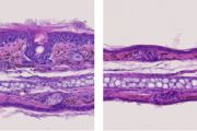 2 CRISPR-Cas9, která umožňuje editovat genetickou informaci uloženou v DNA, byly připraveny buněčné linie a později i geneticky modifikované myši, jimž příslušný gen pro CMTM4 chybí. „Buňky bez CMTM4 ztratily schopnost reagovat na IL-17. Obdobně myši, které postrádaly CMTM4, byly do značné míry ochráněny před autoimunitní lupénkou,“ dodává Ondřej Štěpánek. Vzhledem k zásadní roli IL-17 v některých autoimunitních nemocech se nabízí zatím hypotetická možnost, že CMTM4 by mohl sloužit jako cíl pro budoucí terapii těchto onemocnění. Studie, která významně rozšiřuje poznání o zásadních molekulárních mechanismech imunitního systému, byla publikována v Nature Immunology, jednom z nejprestižnějších imunologických časopisů. Histologická analýza uší laboratorních myší trpících autoimunitní lupénkou. Toto onemocnění se vyznačuje výrazným ztluštěním kůže (vlevo). Naproti tomu myši postrádající CMTM4 jsou před tímto onemocněním výrazně chráněny (vpravo).