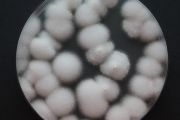 Entomopatogenní houba Cordyceps na laboratorní misce