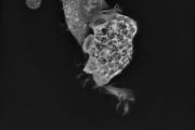 Naegleria fowleri atakuje lidskou buňku 