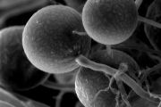 Spory a mycelium arbuskulární mykorhizní houby Glomus tetrastratosum, foto na elektronovém mikroskopu.