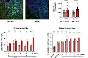 Histologický obrázek (vlevo nahoře) míšních motoneuronů (modře), které obalují perineurální sítě z mezibuněčné hmoty (zeleně). Podáním léčiva došlo k zeslabení perineurálních sítí (nižší intenzita zelené barvy na obrázku nahoře uprostřed). Zeslabení perineurálních sítí umožnilo zvýšit plasticitu nervové tkáně nad i pod místem poranění, což se projevilo vyšším počtem synaptických spojů u léčených zvířat (graf vpravo nahoře). Léčeným potkanům, kteří souběžně s léčbou rehabilitovali na běžícím páse, se zvýšil počet bezchybných kroků při chůzi po žebříku a dosahovali lepších výsledků v testu dosažené maximální rychlosti na běžícím pásu. 