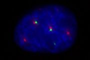 Lokalizace Geminu3 v jádře lidské buňky. Gemin3 označen zeleně, Cajalova tělíska červeně a DNA modře. 