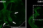 Vývoj obličejových nervů u 11,5 dne starých myších embryí – vlevo normální vývoj hlavových nervů u kontrolního embrya a vpravo vývoj hypoplastickcýh nervů u Cdk13 mutantního embrya. Zeleně zbarvená neurofilamenta – imunohistochemicky obarvené vláknité proteiny nervových buněk znázorňují vyvíjející se nervy a nepravidelné přerušované čáry naznačují obrys vyvíjejícího se obličeje.  Vždy vlevo menší zvětšení, vpravo detail hlavové oblasti se šipkami ukazujícímí na tři hlavní větve trigeminálního nervu prorůstající do hlavních obličejových částí. 
