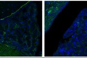 Nanočástice olova narušují celistvost hematoencefalické bariéry, která je zodpovědná za regulaci přenosu látek z krve do mozku. Exprese proteinu NID1 (označen zeleně), jenž je základní stavební jednotkou této bariéry po expozici nanočásticemi olova mizí (vlevo kontrolní tkáň, vpravo exponovaná PbNP s úbytkem exprimovaného proteinu).