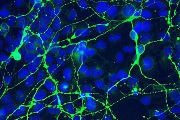 Neurální progenitory vytvořené z pacientských buněk s mutací v genu BRAT1 slouží jako model pro studium vzácných neurovývojových onemocnění. Modře jsou označena buněčná jádra, zeleně výběžky neuronů.